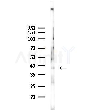 NEIL2 Antibody - Western blot analysis of lysates from 293 cells(starvation,24h treatment), using NEIL2 Antibody at 1/1000 dilution.