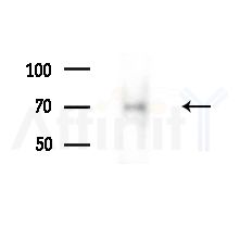 EDEM1 Antibody - Western blot analysis of lysates from Mouse liver, using EDEM1 Antibody at 1/1000 dilution.