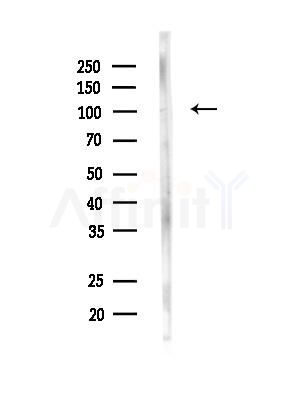 EDEM3 Antibody - Western blot analysis of lysates from MDA-MB-231 cells(heat-shock, 45min treatment), using EDEM3 Antibody at 1/1000 dilution.