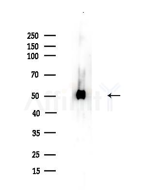 EIF5 Antibody - Western blot analysis of lysates from Mouse brain, using EIF5 Antibody at 1/1000 dilution.