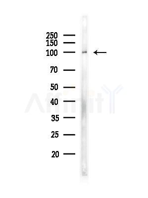ETAA1 Antibody - Western blot analysis of lysates from PC12 cells(heat-shock,45min treatment), using ETAA1 Antibody at 1/1000 dilution.