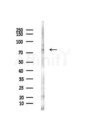 FBLN1 Antibody - Western blot analysis of lysates from COLO205 cells(UV,30min treatment), using FBLN1 Antibody at 1/1000 dilution.