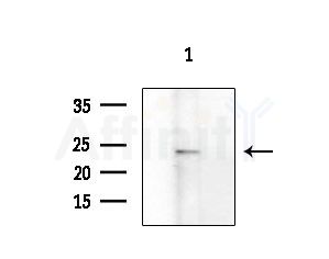 FOLR3 Antibody - Western blot analysis of extracts from COLO205 cells(heat-shock treatment), using FOLR3 Antibody at 1/1000 dilution.