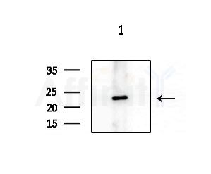 FOLR3 Antibody - Western blot analysis of extracts from 293 cells(starvation treatment), using FOLR3 Antibody at 1/1000 dilution.