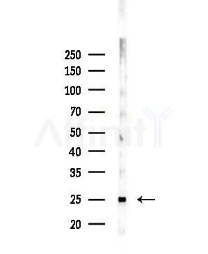FOLR3 Antibody - Western blot analysis of lysates from 293 cells(starvation,24h treatment), using FOLR3 Antibody at 1/1000 dilution.