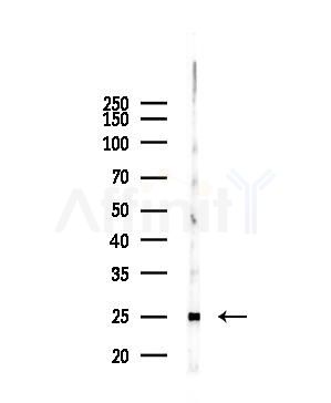 FOLR3 Antibody - Western blot analysis of lysates from COLO205 cells(heat-shock,45min treatment), using FOLR3 Antibody at 1/1000 dilution.