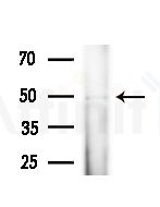 FOXD4L5 Antibody - Western blot analysis of extracts from HepG2 cells(heat-shock treatment), using FOXD4L5 Antibody at 1/1000 dilution.