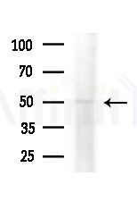 FOXD4L5 Antibody - Western blot analysis of extracts from Mouse liver, using FOXD4L5 Antibody at 1/1000 dilution.