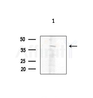 GJB5 Antibody - Western blot analysis of extracts from COLO205 cells(heat-shock treatment), using GJB5 Antibody at 1/1000 dilution.