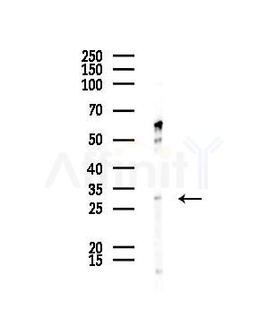 GJB5 Antibody - Western blot analysis of lysates from 293 cells(starvation,24h treatment), using GJB5 Antibody at 1/1000 dilution.