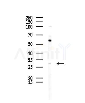GJB5 Antibody - Western blot analysis of lysates from COLO205 cells(heat-shock,45min treatment), using GJB5 Antibody at 1/1000 dilution.