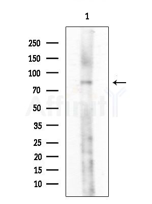 GPSM1 Antibody - Western blot analysis of extracts from Rat lung, using GPSM1 Antibody at 1/1000 dilution.