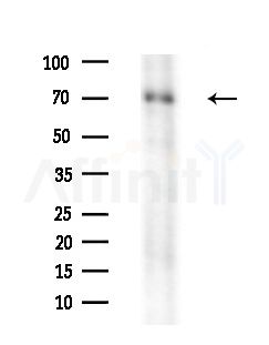 GPSM2 Antibody - Western blot analysis of extracts from Rat brain, using GPSM2 Antibody at 1/1000 dilution.
