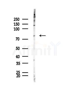 GPSM2 Antibody - Western blot analysis of lysates from Rat brain, using GPSM2 Antibody at 1/1000 dilution.