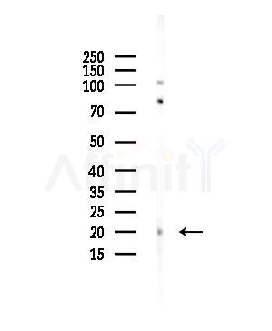 G-CSF Antibody - Western blot analysis of lysates from COLO205 cells(heat-shock,45min treatment), using G-CSF Antibody at 1/1000 dilution.