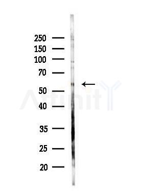 GAS8 Antibody - Western blot analysis of lysates from HepG2 cells(LPS, 4h treatment), using GAS8 Antibody at 1/1000 dilution.