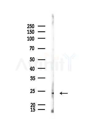 GCH1 Antibody - Western blot analysis of lysates from Rat brain, using GCH1 Antibody at 1/1000 dilution.