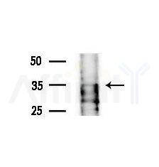 GIMAP7 Antibody - Western blot analysis of extracts from various samples, using GIMAP7 Antibody at 1/1000 dilution.