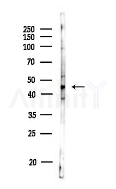 GTPBP5 Antibody - Western blot analysis of lysates from MDA-MB-231 cells(heat-shock,45min treatment), using GTPBP5 Antibody at 1/1000 dilution.