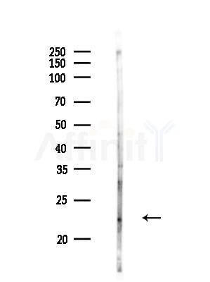 DIRAS2 Antibody - Western blot analysis of lysates from Rat brain, using DIRAS2 Antibody at 1/1000 dilution.