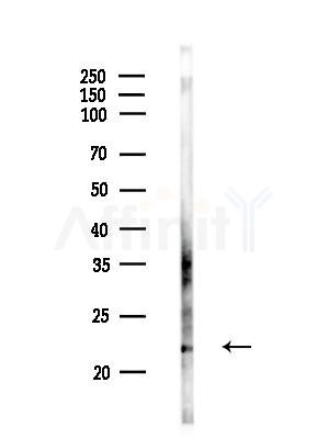 DIRAS2 Antibody - Western blot analysis of lysates from Mouse testis, using DIRAS2 Antibody at 1/1000 dilution.