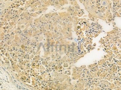 MSS4 Antibody - DF9555 at 1/100 staining human normal lung tissue by IHC-P.