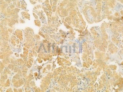 GNG12 Antibody - DF9556 at 1/100 staining human normal lung tissue by IHC-P.
