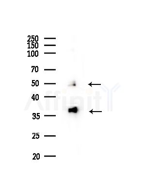 HNRPDL Antibody - Western blot analysis of lysates from Hela cells(heat-shock,45min treatment), using HNRPDL Antibody at 1/1000 dilution.