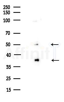 HNRPDL Antibody - Western blot analysis of lysates from A375 cells(LPS,4h treatment), using HNRPDL Antibody at 1/1000 dilution.