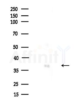 HNRPDL Antibody - Western blot analysis of lysates from Mouse brain, using HNRPDL Antibody at 1/1000 dilution.