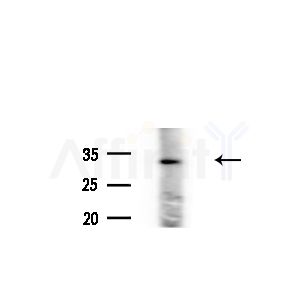HLA-DMA Antibody - Western blot analysis of extracts from Rat brain, using HLA-DMA Antibody at 1/1000 dilution.