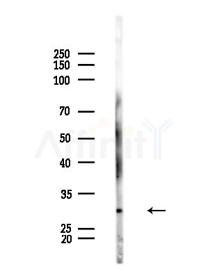 HLA-DMA Antibody - Western blot analysis of lysates from Rat brain, using HLA-DMA Antibody at 1/1000 dilution.