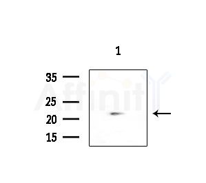 HLA-DQB2 Antibody - Western blot analysis of extracts from COLO205 cells(heat-shock treatment), using HLA-DQB2 Antibody at 1/1000 dilution.