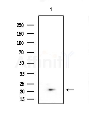 HLA-DQB2 Antibody - Western blot analysis of extracts from 293 cells(starvation treatment), using HLA-DQB2 Antibody at 1/1000 dilution.