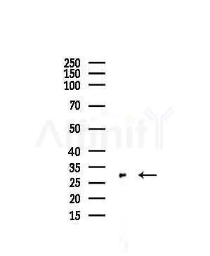 HLA-DQB2 Antibody - Western blot analysis of lysates from 293 cells(starvation,24h treatment), using HLA-DQB2 Antibody at 1/1000 dilution.
