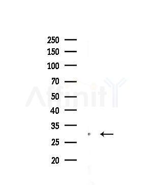HLA-DQB2 Antibody - Western blot analysis of lysates from COLO205 cells(heat-shock,45min treatment), using HLA-DQB2 Antibody at 1/1000 dilution.