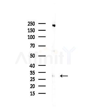 HOXB1 Antibody - Western blot analysis of lysates from COLO205 cells(heat-shock,45min treatment), using HOXB1 Antibody at 1/1000 dilution.