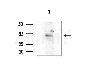 HOXB8 Antibody - Western blot analysis of extracts from 293 cells(starvation treatment), using HOXB8 Antibody at 1/1000 dilution.