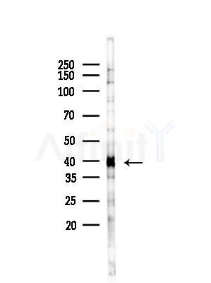 HOXD11 Antibody - Western blot analysis of lysates from B16F10-LUC cells(heat-shock,45min treatment), using HOXD11 Antibody at 1/1000 dilution.