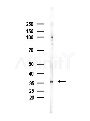 HOXD9 Antibody - Western blot analysis of lysates from Mouse brain, using HOXD9 Antibody at 1/1000 dilution.