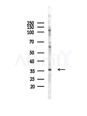HOXD9 Antibody - Western blot analysis of lysates from RAW264.