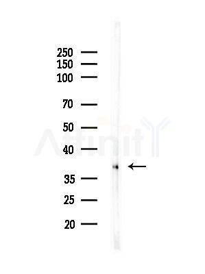 NKX61 Antibody - Western blot analysis of lysates from Rat liver, using NKX61 Antibody at 1/1000 dilution.