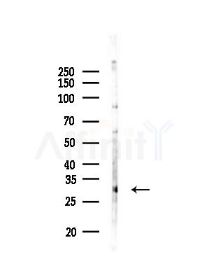 NKX62 Antibody - Western blot analysis of lysates from COLO205 cells(heat-shock,45min treatment), using NKX62 Antibody at 1/1000 dilution.