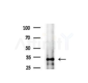 KIR2DL2 Antibody - Western blot analysis of extracts from various samples, using KIR2DL2 Antibody at 1/1000 dilution.