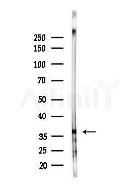 KIR2DL2 Antibody - Western blot analysis of lysates from HepG2 cells(LPS, 4h treatment), using KIR2DL2 Antibody at 1/1000 dilution.