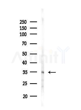 KIR2DS5 Antibody - Western blot analysis of lysates from HepG2 cells(LPS, 4h treatment), using KIR2DS5 Antibody at 1/1000 dilution.