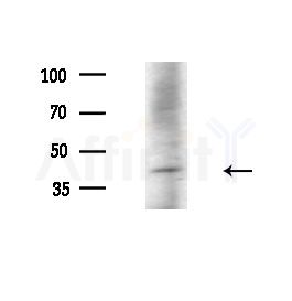 A4GALT Antibody - Western blot analysis of lysates from Rat liver, using A4GALT Antibody at 1/1000 dilution.