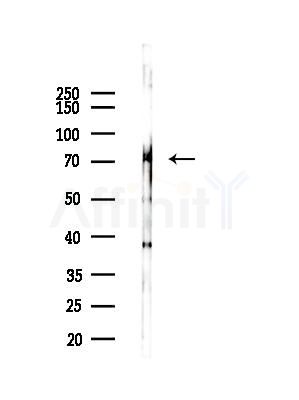 LILRB1 Antibody - Western blot analysis of lysates from COLO205 cells(UV,30min treatment), using LILRB1 Antibody at 1/1000 dilution.