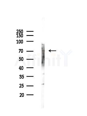 LILRB1 Antibody - Western blot analysis of lysates from LoVo cells(heat-shock,45min treatment), using LILRB1 Antibody at 1/1000 dilution.
