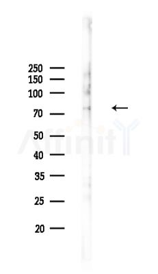 ACSL5 Antibody - Western blot analysis of lysates from COLO205 cells, using ACSL5 Antibody at 1/1000 dilution.